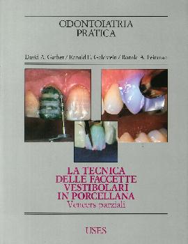 La Tecnica delle Faccette Vestibolari in Porcellana