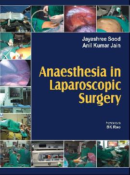 Anaesthesia in laparoscopic surgery