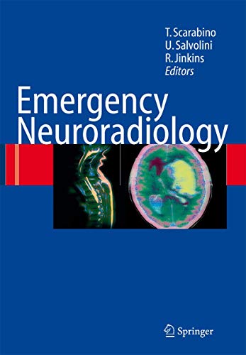 Image of Emergency Neuroradiology - [Springer Distribution Center GmbH (SDC)]