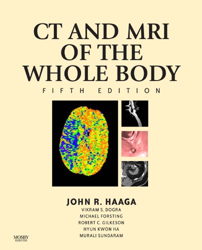 Image of Computed Tomography & Magnetic Resonance Imaging of the Whole Body (Computed Tom